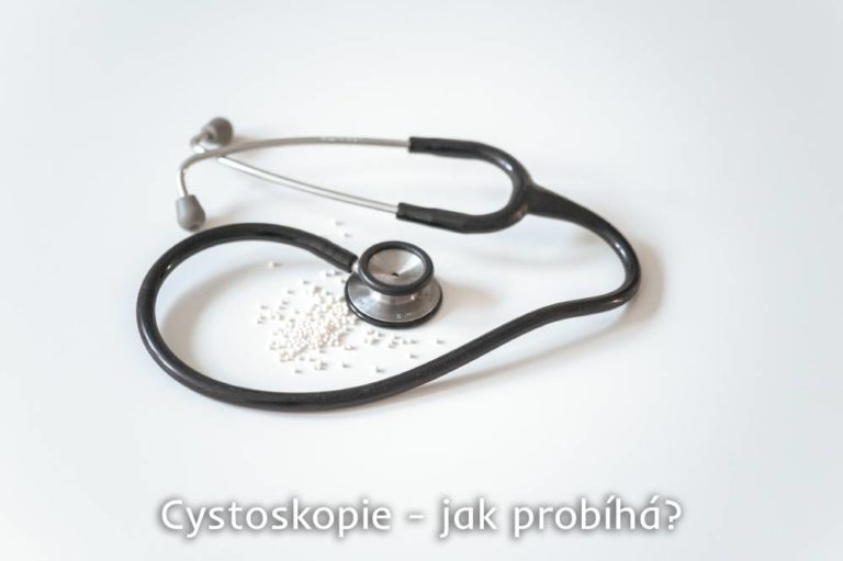 cystoskopie