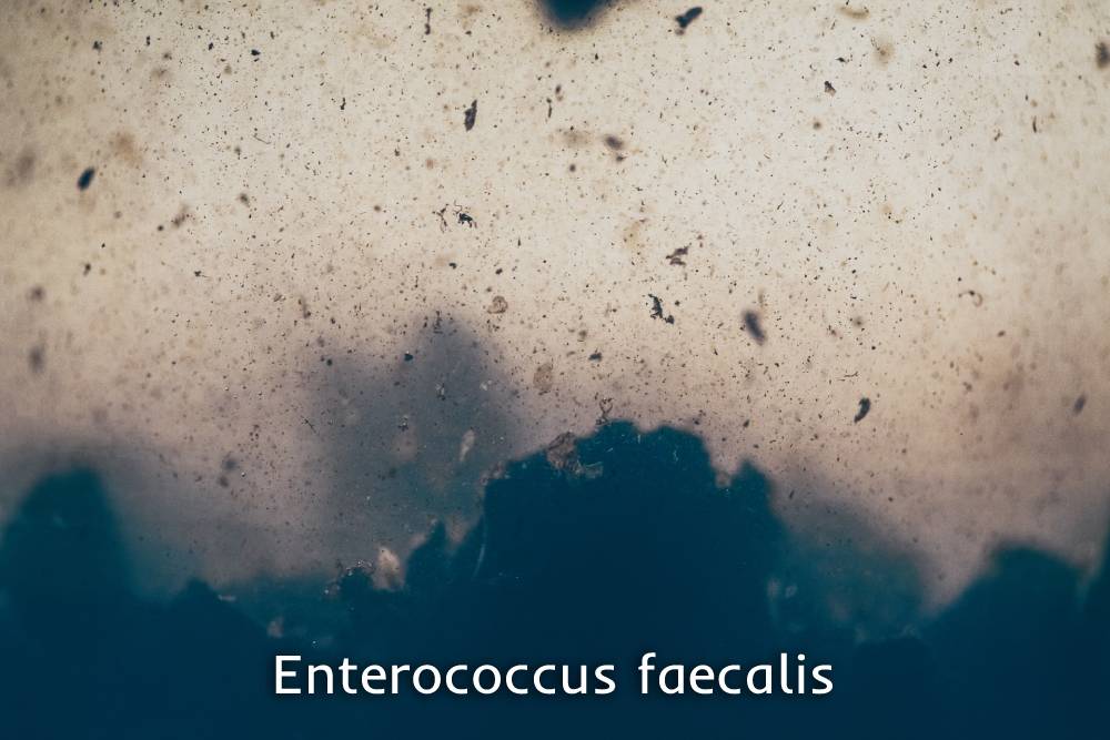 Enterococcus faecalis