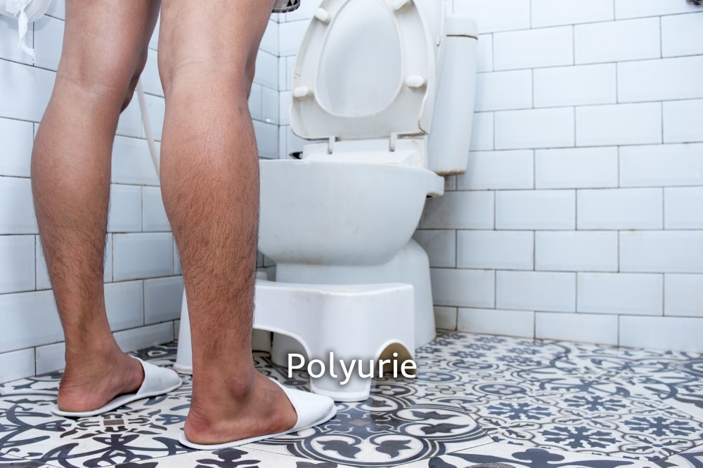 polyurie