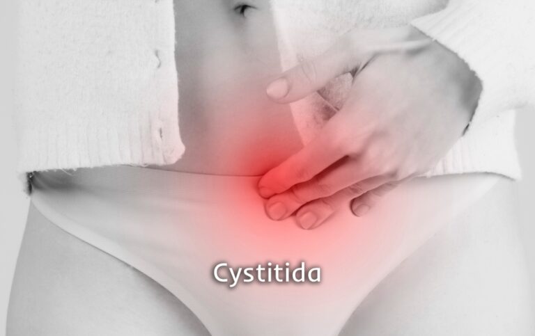 Cystitida